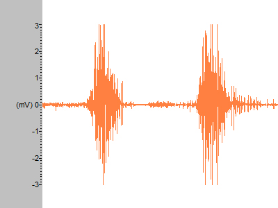 EMG Muscle Activity Data recorded at 60uV EMG Muscle Activity Data recorded at 60uV