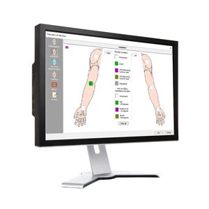 Upper Extremity Impairement Calculation Software